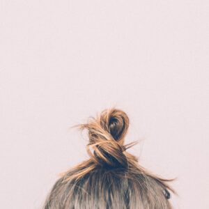 Photo Hair Loss