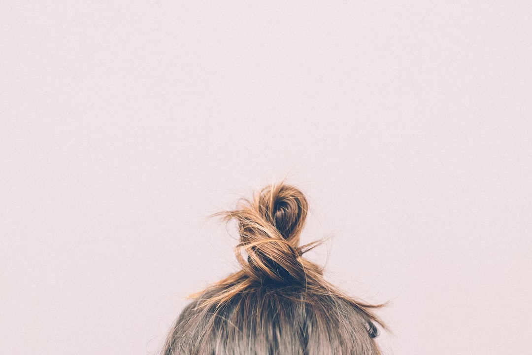 Photo Hair Loss