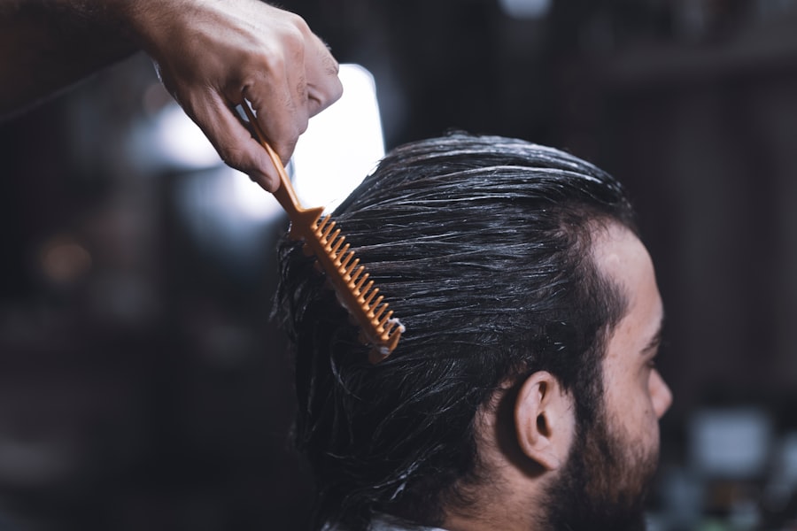 Photo Hair Loss